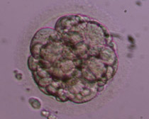 6-cell Grade IV
